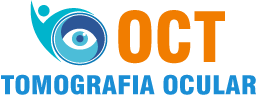 tomografia ocular oct
