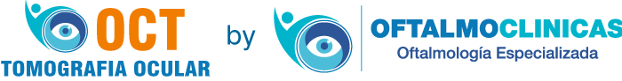tomografia oct